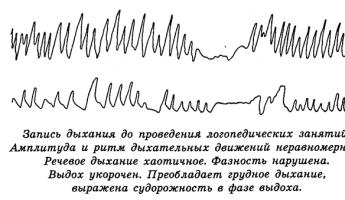 Структура логопедического занятия по дифференциации звуков